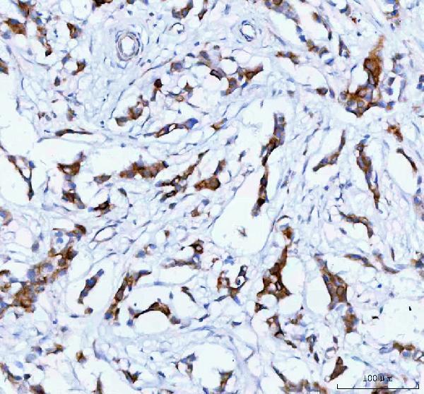  IHC analysis of TACI using anti-TACI antibody (A02952-1)