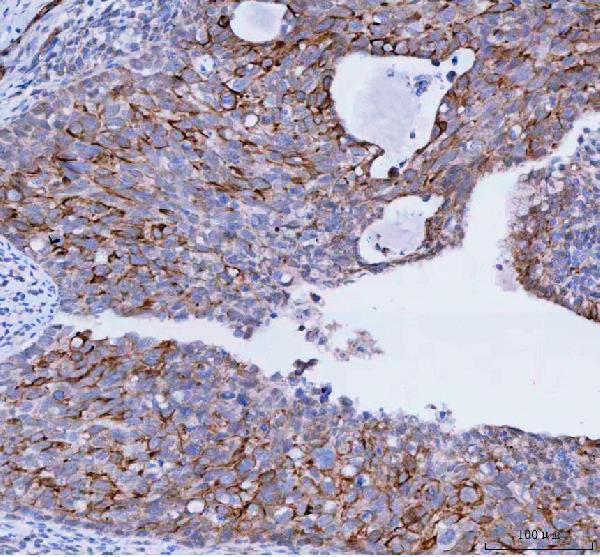  IHC analysis of TACI using anti-TACI antibody (A02952-1)