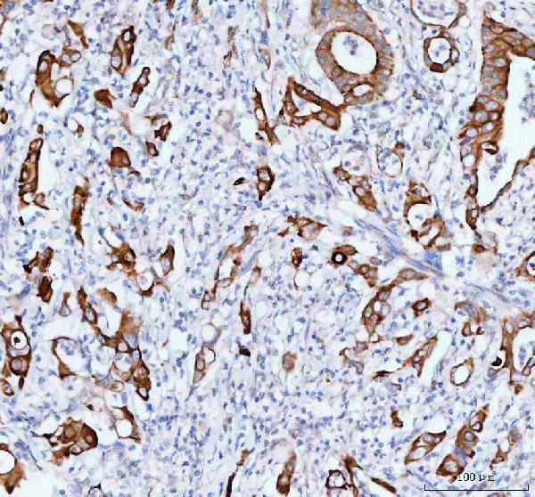  IHC analysis of TACI using anti-TACI antibody (A02952-1)
