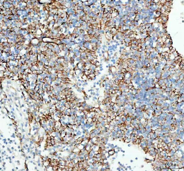 a02952 1 taci primary antibodies ihc testing 4