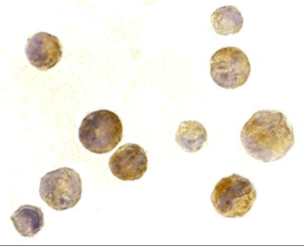 Immunocytochemistry of TACI in K562 cells with TACI antibody at 2 μg/mL