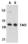 Western blot analysis of TACI in K562 (A) and U937 (B) cell lysates with TACI antibody at 5 μg/mL