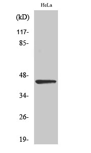 Western blotting validation for Anti-Endonuclease 8-like 1 NEIL1 Antibody A02953
Western Blot (WB) analysis of specific cells using NEIL1 polyclonal antibody