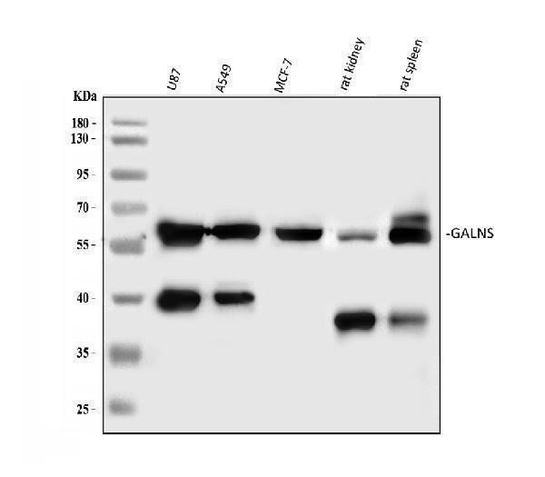 a02954 1 galns primary antibodies wb testing 1
