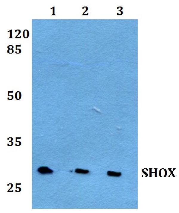 a02956 shox primary antiboties wb testing 1