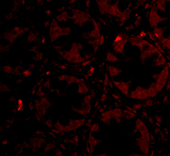 a02957 1 ptk7 primary antibodies if testing 3