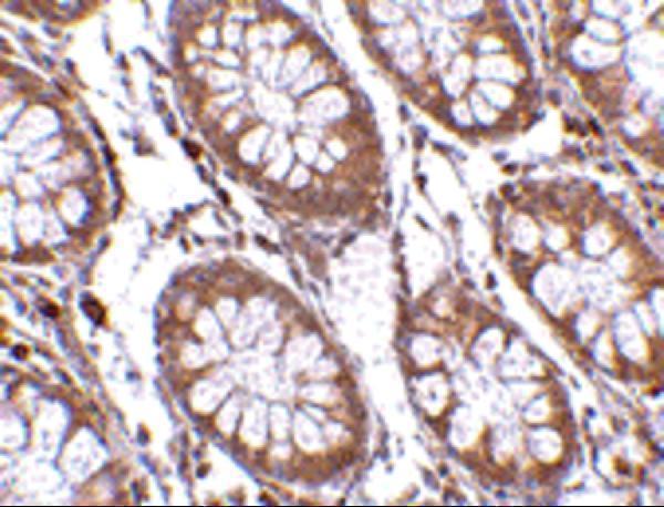 a02957 1 ptk7 primary antibodies ihc testing 2