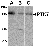 a02957 1 ptk7 primary antibodies wb testing 1