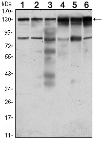 Western Blot analysis using CCK-4 Monoclonal Antibody against HeLa (1), A431 (2), HCT116 (3), Caco2 (4), HepG2 (5) and MCF-7 (6) cell lysate