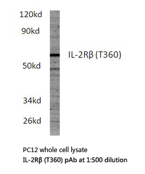 Western blot (WB) analysis of IL-2Rβ (T360) polyclonal antibody in extracts from PC12 cells