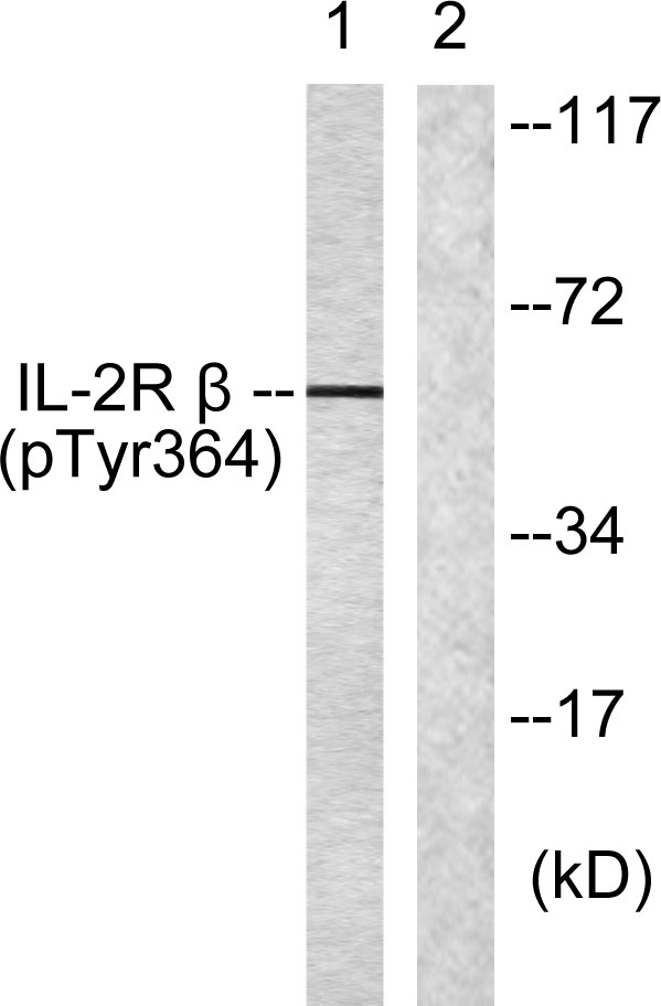 Western blot analysis of lysates from HeLa cells, using IL-2R beta (Phospho-Tyr364) Antibody