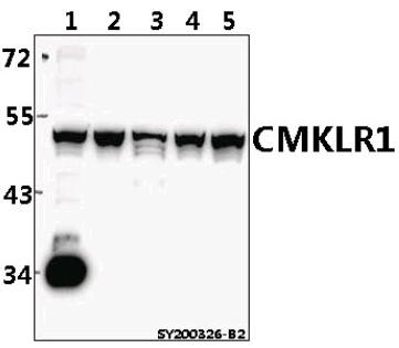 Western blot (WB) analysis of CMKLR1 pAb at 1:500 dilution
Lane1:RAW264