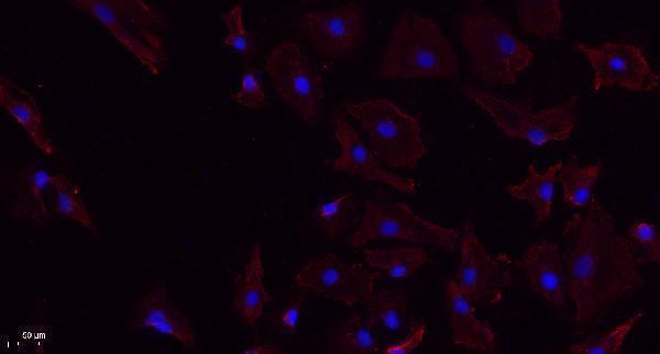 a02960 cmklr1 primary antibodies if testing 1
