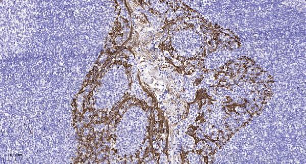 a02960 cmklr1 primary antibodies ihc testing 6