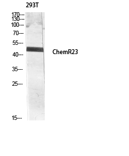 a02960 cmklr1 primary antibodies wb testing 4
