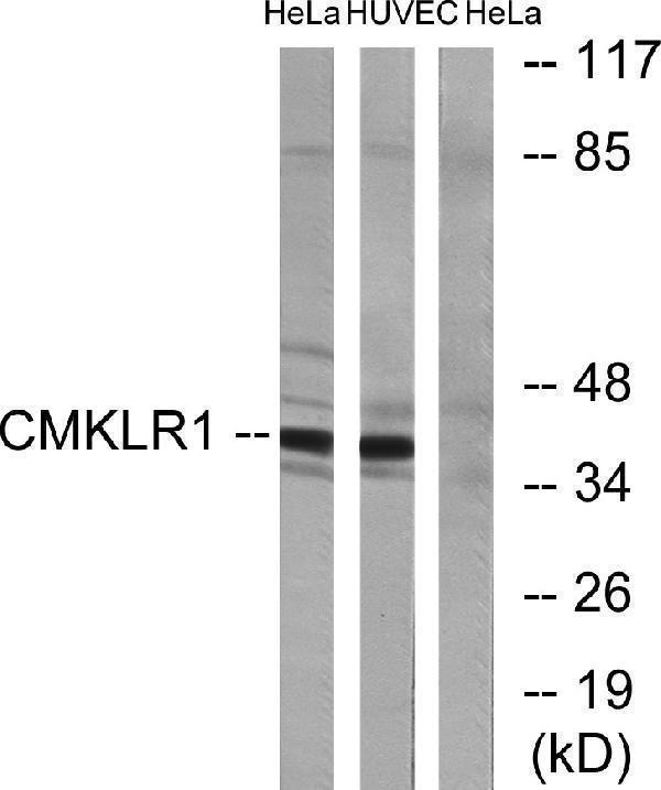 a02960 cmklr1 primary antibodies wb testing 5