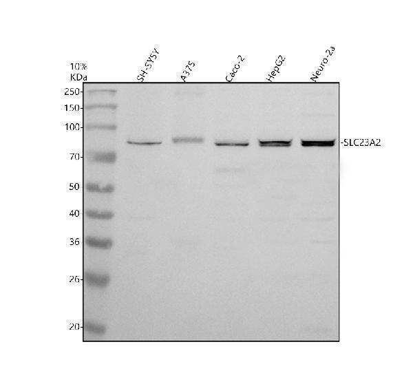 Western blot analysis of SLC23A2 using anti-SLC23A2 antibody (A02962-1)