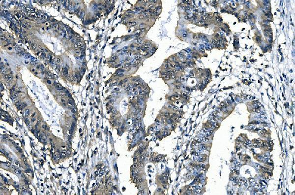 a02964 2 slbp primary antibodies ihc testing 2