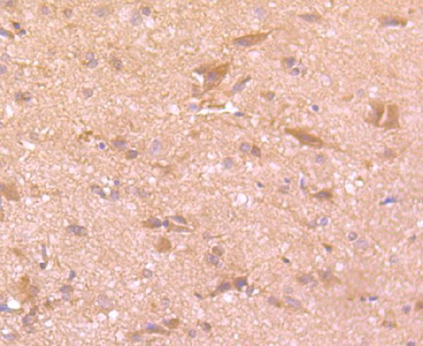 Immunohistochemical analysis of paraffin-embedded rat brain tissue using anti-PLAT antibody
