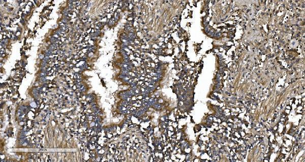  IHC analysis of EPRS1/PARS using anti-EPRS1/PARS antibody (A02967-2)