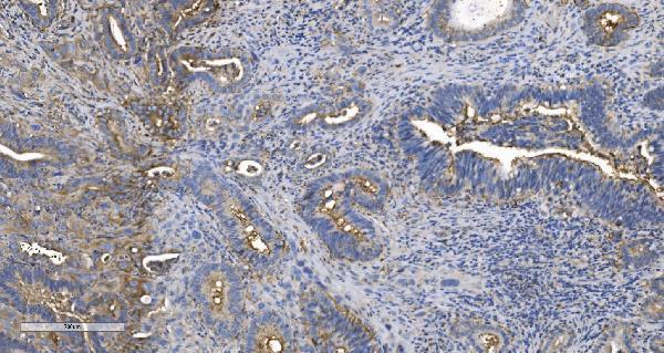 a02967 2 eprs primary antibodies ihc testing 3