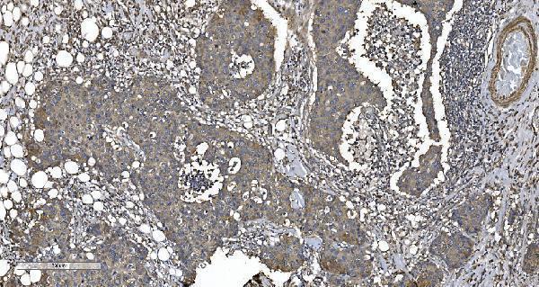 a02967 2 eprs primary antibodies ihc testing 5