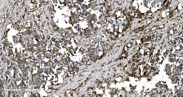 a02967 2 eprs primary antibodies ihc testing 6