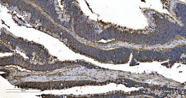 a02967 2 eprs primary antibodies ihc testing 7