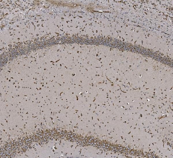 a02967 2 eprs primary antibodies ihc testing 8