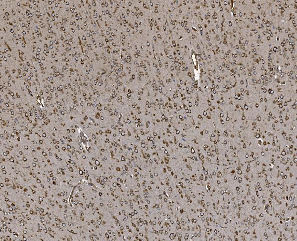 a02967 2 eprs primary antibodies ihc testing 9