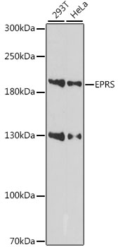a02967 eprs primary antiboties wb testing 1