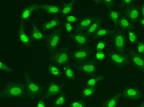 a02968 aptx primary antiboties if testing 2