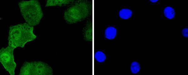 ICC staining Islet 1 in A549 cells (green)