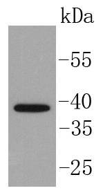 Western blot analysis of Islet 1 on MCF-7 cell lysates using anti-Islet 1 antibody at 1/1,000 dilution