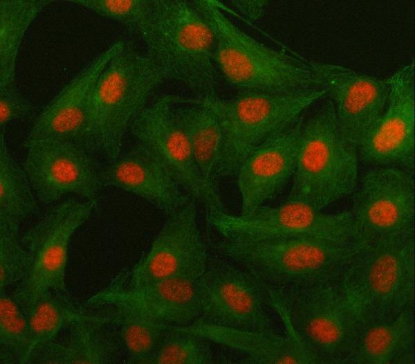 a02969 3 isl1 primary antibodies if testing 4