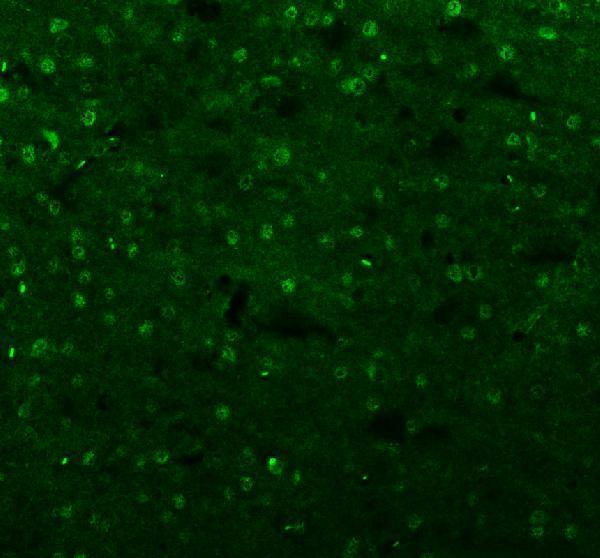 a02969 3 isl1 primary antibodies if testing 5