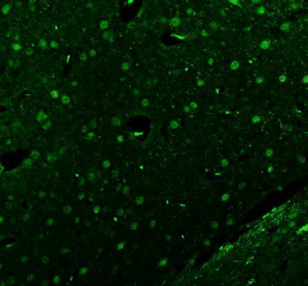 a02969 3 isl1 primary antibodies if testing 6