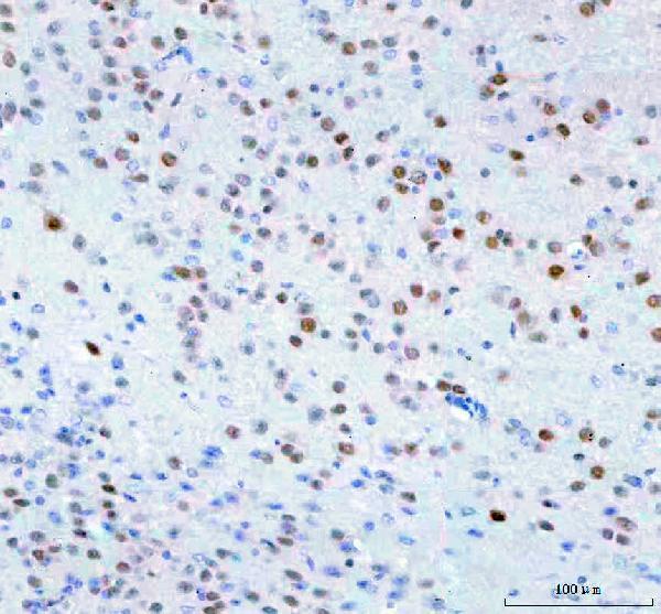  IHC analysis of Islet 1/ISL1 using anti-Islet 1/ISL1 antibody (A02969-3)