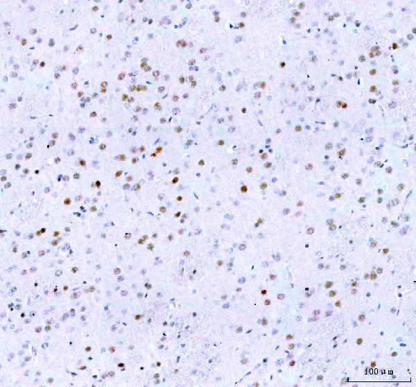  IHC analysis of Islet 1/ISL1 using anti-Islet 1/ISL1 antibody (A02969-3)