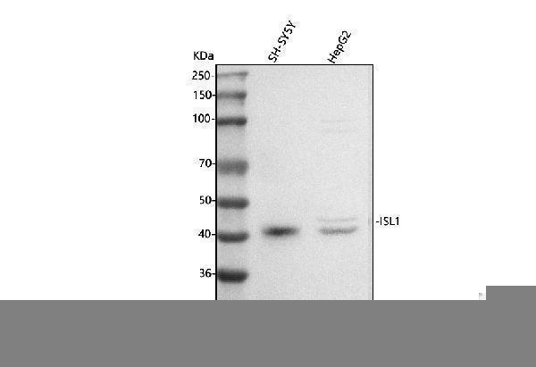  Western blot analysis of Islet 1/ISL1 using anti-Islet 1/ISL1 antibody (A02969-3)