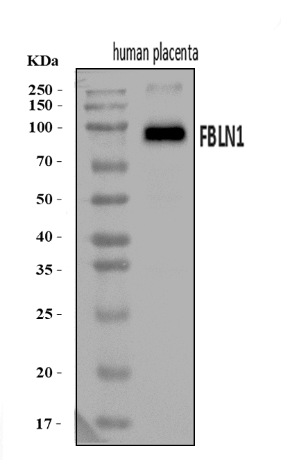  Western blot analysis of Fibulin 1/FBLN1 using anti-Fibulin 1/FBLN1 antibody (A02970-1)