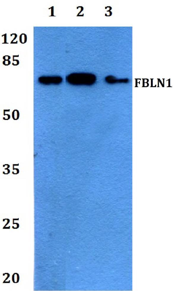 a02970 fbln1 primary antiboties wb testing 1