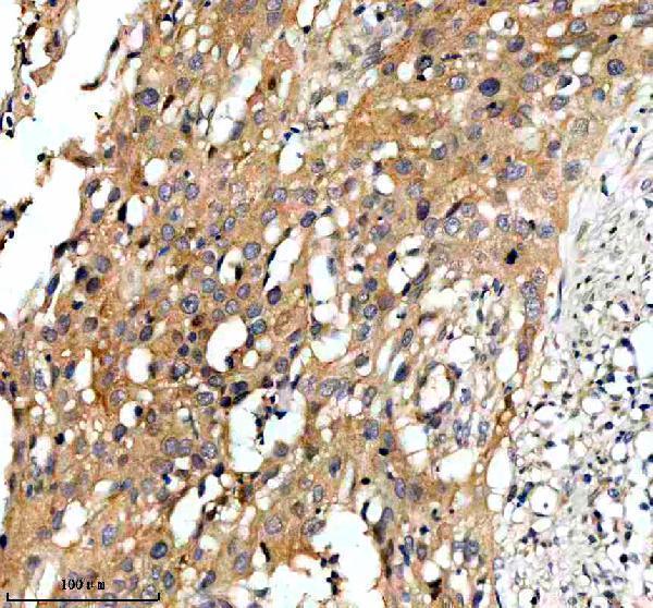 IHC analysis of PYGM using anti-PYGM antibody (A02971-1)