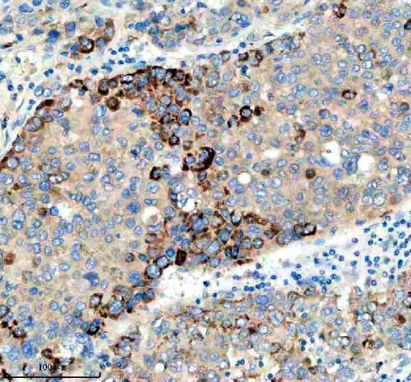 a02971 1 pygm primary antibodies ihc testing 3
