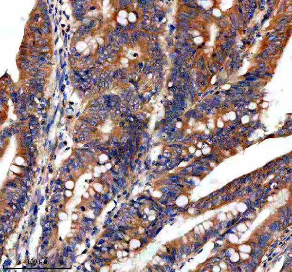 a02971 1 pygm primary antibodies ihc testing 4