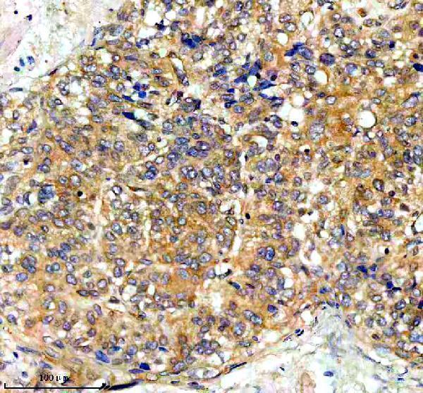 a02971 1 pygm primary antibodies ihc testing 6
