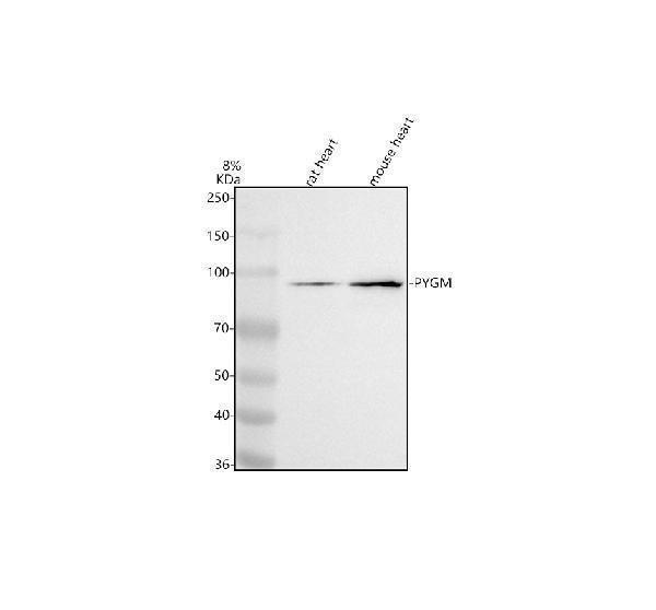 Western blot analysis of PYGM using anti-PYGM antibody (A02971-1)