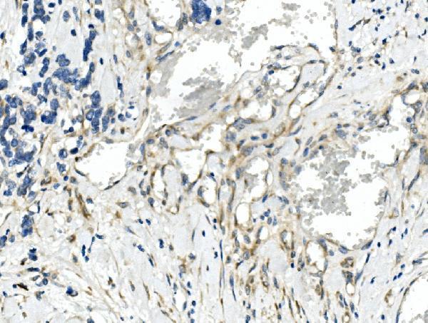 a02973 2 cdr2 primary antibodies ihc testing 2