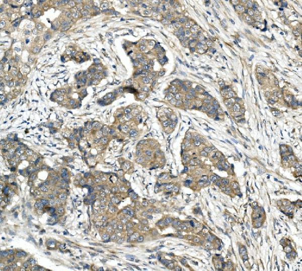 a02973 2 cdr2 primary antibodies ihc testing 3