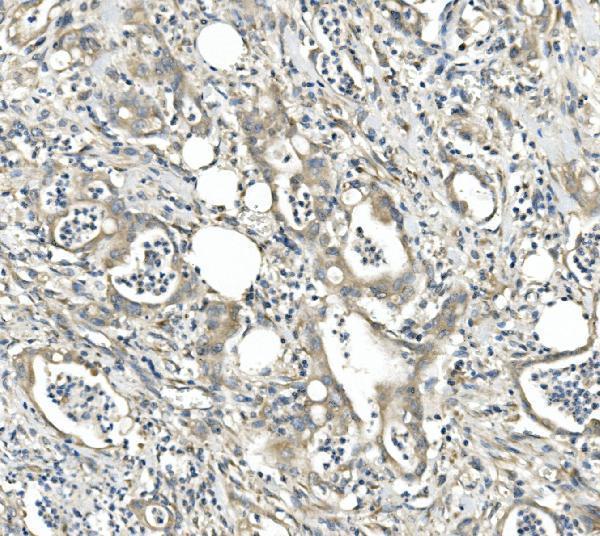 a02973 2 cdr2 primary antibodies ihc testing 4